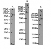 Western blot testing of human 1) U937, B) K562 and C) MOLT-4 cell lysates with LFA-1 antibody  Predicted/observed molecular weight: 85~95 kDa depending on glycosylation level.