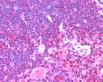 IHC staining of FFPE human thymus with Munc13-4 antibody at 2.5ug/ml. HIER: steamed with pH6 citrate buffer, AP-staining.
