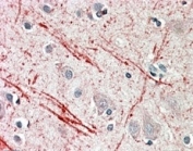 IHC testing of FFPE human cerebellum with IGF2 antibody at 5ug/ml. HIER: steamed with pH6 citrate buffer, AP-staining.
