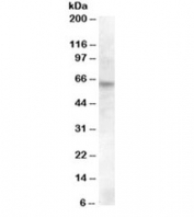 Western blot testing of rat retina lysate with RPE65 antibody at 0.5ug/ml. Predicted molecular weight 60~65kDa.