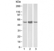 Western blot testing of lysate from 1) human, 2) mouse and 3) rat liver with ALDH1A1 antibody at 0.1ug/ml. Predicted molecular weight ~55 kDa.