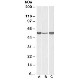 Western blot testing of human [A] and mouse [B] liver, and rat [C] testis lysate with ALDH1A1 antibody at 0.3ug/ml. Predicted molecular weight ~55kDa.