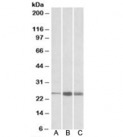 Western blot testing of human [A], mouse [B] and rat [C] skeletal muscle lysate with TNNI2 antibody at 1ug/ml. Predicted molecular weight: ~21kDa, observed here at ~25kDa.