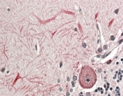 IHC staining of FFPE human cerebellum with KEAP1 antibody at 4ug/ml. HIER: steamed with pH6 citrate buffer, AP-staining.