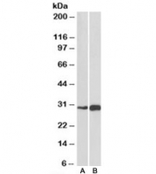 Western blot testing of mouse (A) and rat (B) skeletal muscle lysate with ATF5 antibody at 1ug/ml. Predicted molecular weight: ~31kDa.