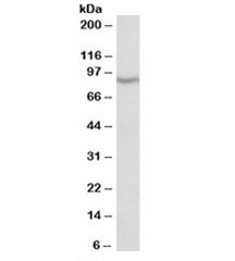 Western blot testing of human testis lysate with NOX5 antibody at 0.5ug/ml. Predicted/observed molecular weight: ~86kDa.