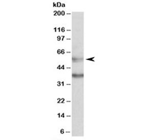 Western blot testing of K562 lysate with CBARA1 antibody at 0.5ug/ml. Predicted molecular weight: ~55kDa. Both observed bands are blocked with addition of the immunizing peptide.~