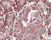 IHC staining of FFPE human pancreas with PDIA2 antibody at 4ug/ml. HIER: steamed with pH6 citrate buffer, AP-staining.