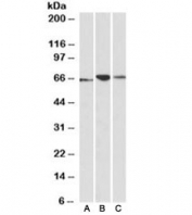 Western blot testing of human [A], mouse [B] and rat [C] pancreas lysates with PDIA2 antibody at 0.1ug/ml. Predicted molecular weight ~58/70kDa (unmodified/glycosylated).