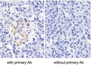 IHC testing of FFPE human pancreas tissue with and without CCKBR antibody at 5ug/ml. Required HIER: steamed antigen retrieval with pH6 citrate buffer; HRP-staining.