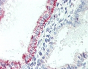 IHC testing of FFPE human uterus tissue with CCKBR antibody at 5ug/ml. Required HIER: steamed antigen retrieval with pH6 citrate buffer; AP-staining.