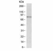 Western blot testing of mouse pancreas with CCKBR antibody at 1ug/ml. Predicted molecular weight ~48 kDa, but can be observed at 68-97 kDa.