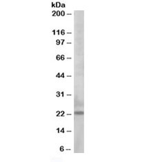 Western blot testing of K562 lysate with Bim antibody at 0.5ug/ml. Predicted molecular weight ~19kDa.