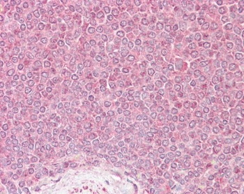 IHC testing of FFPE human spleen tissue with VPS45 antibody at 2.5ug/ml. Required HIER: steamed antigen retrieval with