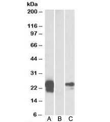 Western blot test of HEK293 lysate overexpressing human WFDC2-MYC with WFDC2 antibody [1ug/ml] in Lane A and anti-MYC [1/1000] in lane C. Mock-transfected HEK293 probed with WFDC2 antibody [1ug/ml] in Lane B. Predicted molecular weight: ~13/25kDa (unmodified/glycosylated).