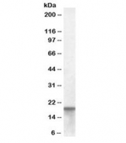 Western blot testing of human colon lysate with AGR2 antibody at 0.01ug/ml. Expected molecular weight: 17-20 kDa.