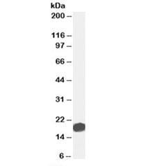 Western blot testing of human duodenum lysate with AGR2 antibody at 0.01ug/ml. Predicted molecular weight: ~20kDa.