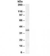 Western blot testing of peripheral blood mononucleocyte lysate with LAT1 antibody at 0.01ug/ml. Predicted molecular weight ~28kDa, routinley observed at ~36kDa.