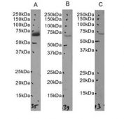Western blot testing of A) human A431, B) mouse NIH 3T3 and C) human HepG2 cell lysate (nuclear fractions) with NO66 antibody at 0.1ug/ml. Predicted molecular weight: ~71 kDa.