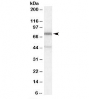 Western blot testing of A431 cell lysate with NO66 antibody at 0.3ug/ml. Predicted/observed molecular weight: ~71kDa. Both observed bands are blocked by addition of the immunizing peptide.