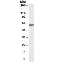 Western blot testing of human tonsil lysate with RAP1 antibody at 0.2ug/ml. Predicted molecular weight ~44kDa but routinely observed at 55~60kDa.