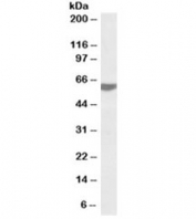 Western blot testing of human tonsil lysate with RAP1 antibody at 0.2ug/ml. Predicted molecular weight ~44kDa but routinely observed at 55~60kDa