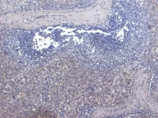 Negative control: IHC staining of FFPE human spleen tissue without Septin 1 antibody. Required HIER: steamed antigen retrieval with pH6 citrate buffer.