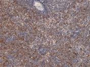 IHC staining of FFPE human spleen tissue with Septin 1 antibody at 6ug/ml. Required HIER: steamed antigen retrieval with pH6 citrate buffer.