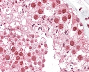 IHC testing of FFPE human testis with MSH5 antibody at 4ug/ml. HIER: steamed with pH6 citrate buffer, AP-staining.
