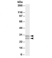 Western blot testing of human testis lysate with COMT antibody at 0.3ug/ml. Predicted molecular weight: ~30/25kDa (isoforms 1/2).