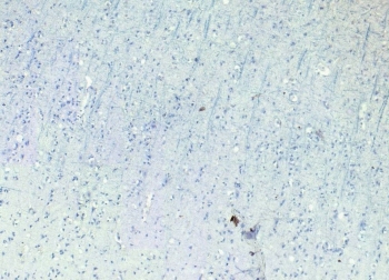 Negative control: IHC staining of FFPE human cortex tissue without primary antibody. Required HIER: steamed antigen retrieval with pH6 citrate buffer; HRP-staining.