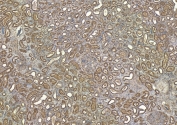 IHC staining of FFPE human kidney tissue with ROBO1 antibody at 6ug/ml. Required HIER: steamed antigen retrieval with pH6 citrate buffer; HRP-staining.