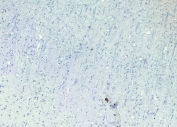 Negative control: IHC staining of FFPE human cortex tissue without primary antibody. Required HIER: steamed antigen retrieval with pH6 citrate buffer; HRP-staining.