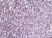 IHC staining of FFPE human spleen with AIM2 antibody at 4ug/ml. HIER: steamed with pH6 citrate buffer, AP-staining.
