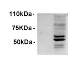 Western blot testing of IFNb-treated WI-38 lysate with AIM2 antibody at 1ug/ml. Predicted molecular weight ~39kDa.~