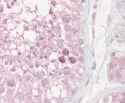 IHC staining of FFPE human testis with TRIM69 antibody at 4ug/ml. HIER: steamed with pH6 citrate buffer, AP-staining.