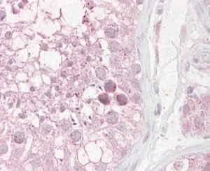 IHC staining of FFPE human testis with TRIM69 antibody at 4ug/ml. HIER: steamed with pH6 citrate buffer, AP-sta