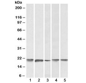 Western blot testing of human 1) cerebellum, 2) liver, 3) placenta, 4) mouse brain and 5) rat brain lysate with FTL antibody at 0.1ug/ml. Predicted molecular weight: ~20 kDa.~