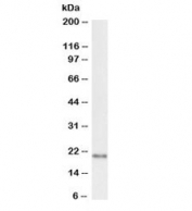 Western blot testing of rat brain lysate with biotinylated FTL antibody at 1ug/ml. Predicted molecular weight: ~20kDa.