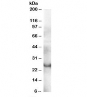 Western blot testing of human thymus lysate with GRAP antibody at 0.3ug/ml. Predicted molecular weight: ~25kDa.