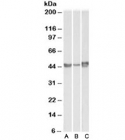 Western blot of A549 (A), HepG2 (B) and HeLa (C) lysates with PAI-1 antibody at 0.1ug/ml. Predicted molecular weight ~45kDa.