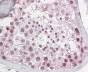 IHC staining of FFPE human testis with Pescadillo antibody at 4ug/ml. HIER: steamed with pH6 citrate buffer, AP-staining.