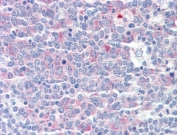 IHC testing of FFPE human tonsil tissue with CCT3 antibody at 5ug/ml. Required HIER: steamed antigen retrieval with pH6 citrate buffer; AP-staining.
