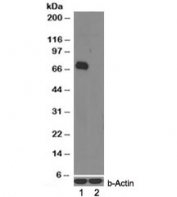 Western blot of mouse bone marrow (wildtype first lane, KO second lane) lysates with IRAK3 antibody at 0.5ug/ml. Predicted molecular weight: ~68kDa.