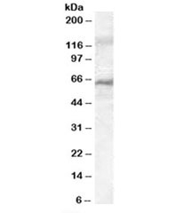 Western blot testing of rat liver lysate with IRAK3 antibody at 0.05ug/ml. Predicted molecular weight: ~68kDa.~
