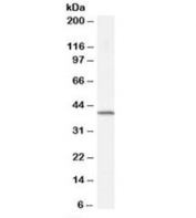 Western blot testing of human spleen lysate with Dysadherin antibody at 0.5ug/ml. Predicted molecular weight: ~19kDa.