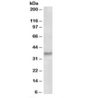 Western blot testing of human tonsil lysate with GCH1 antibody at 0.5ug/ml. Predicted molecular weight ~28kDa, observed here at ~37kDa.