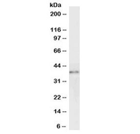 Western blot testing of Jurkat lysate with GRAP2 antibody at 0.5ug/ml. Predicted molecula