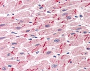 IHC testing of FFPE human heart tissue with Gamma Catenin antibody at 5ug/ml. Required HIER: steamed antigen retrieval with pH6 citrate buffer; AP-staining.
