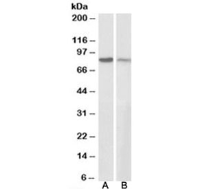 Western blot testing of human A431 [A] and mouse NIH3T3 [B] cell lysates with Gamma-catenin antibody at 0.3ug/ml. Predicted molecular weight ~82kDa.
